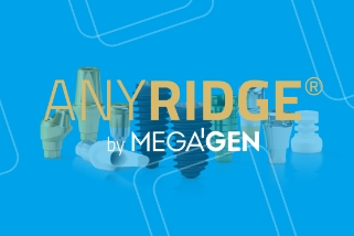 【美格真】Anyridge